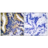 Immunohistochemistry - Anti-BIK Antibody (B0053) - Antibodies.com