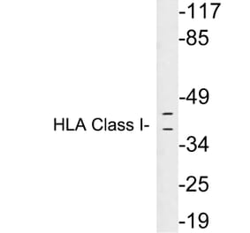 Western Blot - Anti-HLA Class I Antibody (R12-2182) - Antibodies.com