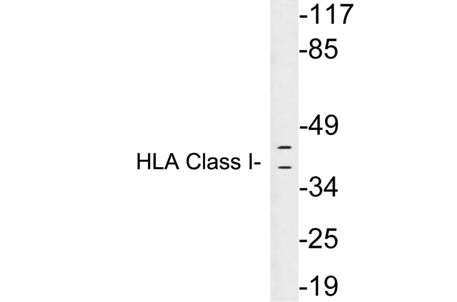 Western Blot - Anti-HLA Class I Antibody (R12-2182) - Antibodies.com