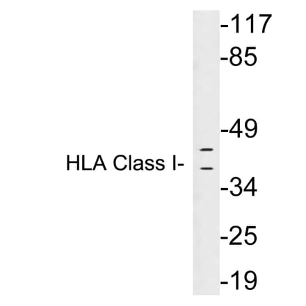 Western Blot - Anti-HLA Class I Antibody (R12-2182) - Antibodies.com