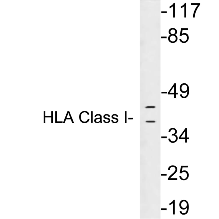 Western Blot - Anti-HLA Class I Antibody (R12-2182) - Antibodies.com