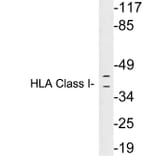 Western Blot - Anti-HLA Class I Antibody (R12-2182) - Antibodies.com