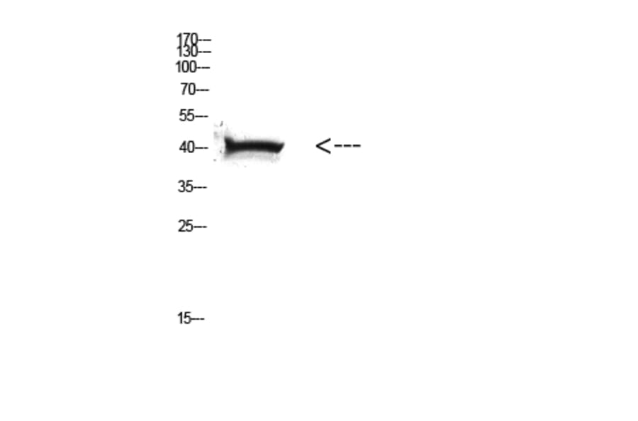 Western Blot - Anti-HLA Class I Antibody (R12-2182) - Antibodies.com