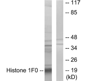 Western Blot - Anti-Histone 1F0 Antibody (C10293) - Antibodies.com