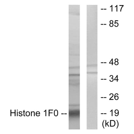 Western Blot - Anti-Histone 1F0 Antibody (C10293) - Antibodies.com