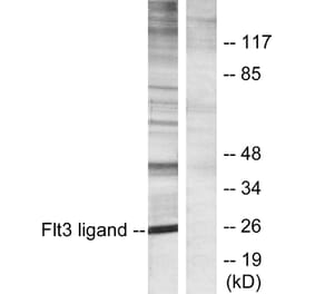 Western Blot - Anti-Flt3 ligand Antibody (C10654) - Antibodies.com