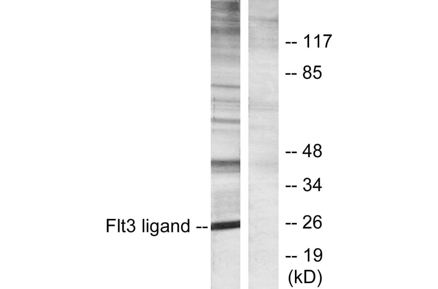 Western Blot - Anti-Flt3 ligand Antibody (C10654) - Antibodies.com