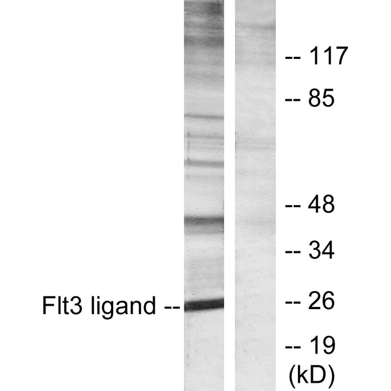 Western Blot - Anti-Flt3 ligand Antibody (C10654) - Antibodies.com