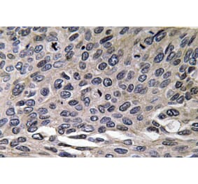 Immunohistochemistry - Anti-MIP-1alpha Antibody (R12-2239) - Antibodies.com