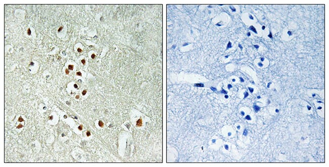 Immunohistochemical analysis of paraffin-embedded human brain using Anti-GADD45GIP1 Antibody. The right hand panel represents a negative control, where the antibody was pre-incubated with the immunising peptide.