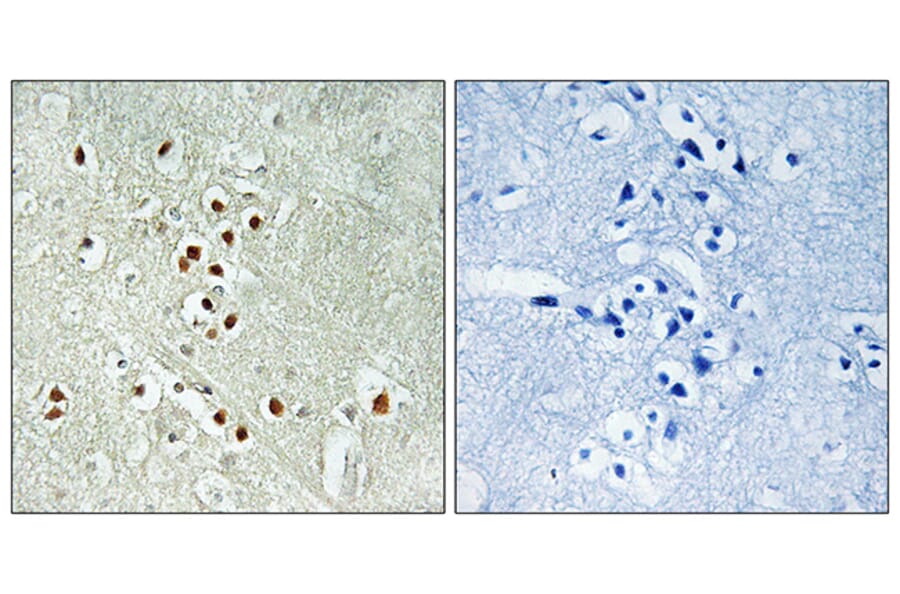 Immunohistochemistry - Anti-GADD45GIP1 Antibody (C15969) - Antibodies.com