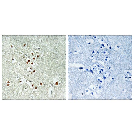 Immunohistochemistry - Anti-GADD45GIP1 Antibody (C15969) - Antibodies.com