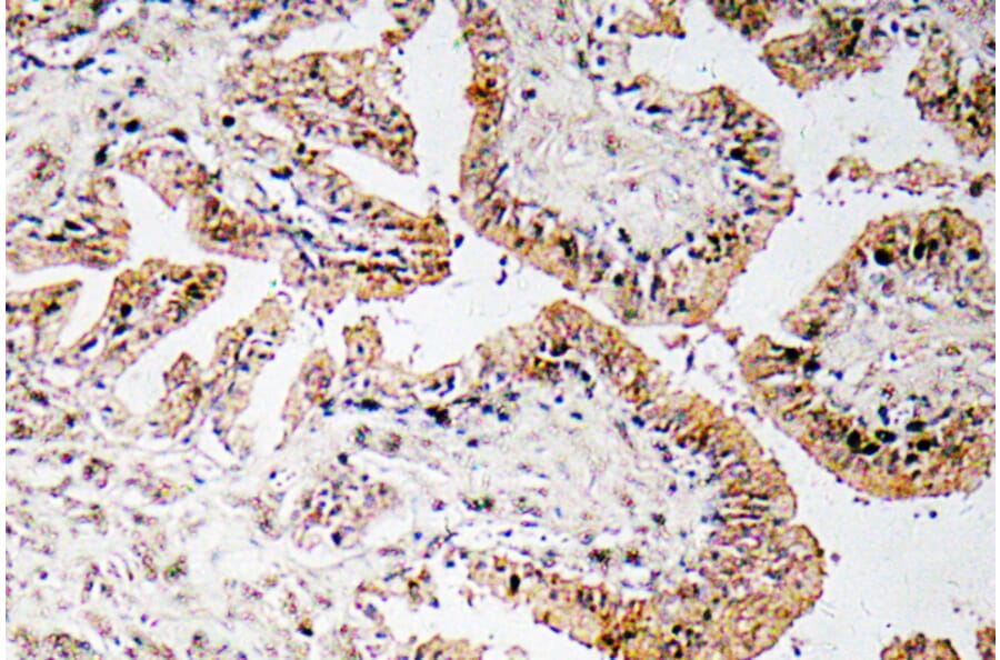 Immunohistochemistry - Anti-Calcitonin Antibody (R12-2050) - Antibodies.com