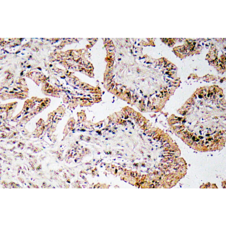 Immunohistochemistry - Anti-Calcitonin Antibody (R12-2050) - Antibodies.com