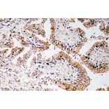 Immunohistochemistry - Anti-Calcitonin Antibody (R12-2050) - Antibodies.com