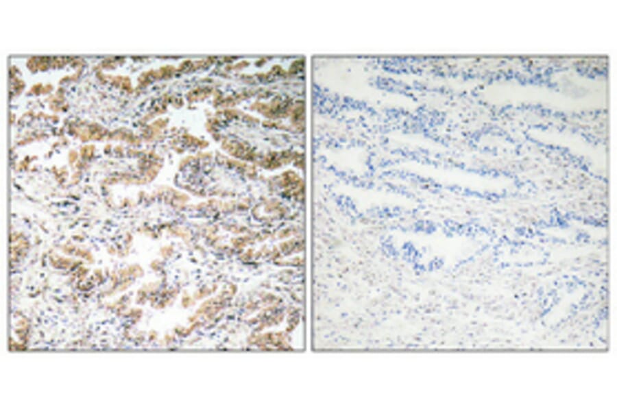 Immunohistochemistry - Anti-Calcitonin Antibody (R12-2050) - Antibodies.com