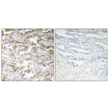 Immunohistochemistry - Anti-Calcitonin Antibody (R12-2050) - Antibodies.com