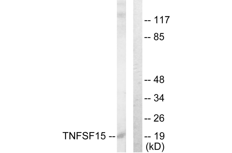 Western Blot - Anti-TNFSF15 Antibody (C10215) - Antibodies.com