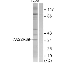 Western Blot - Anti-TAS2R39 Antibody (G756) - Antibodies.com
