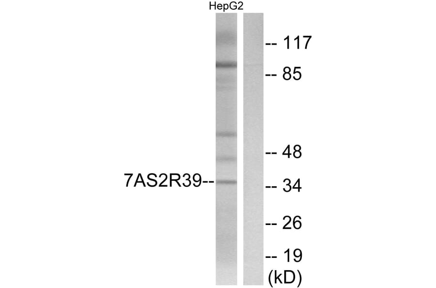 Western Blot - Anti-TAS2R39 Antibody (G756) - Antibodies.com