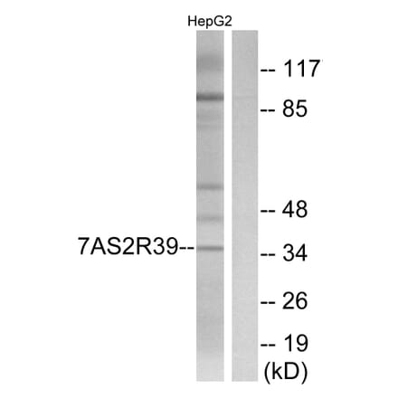 Western Blot - Anti-TAS2R39 Antibody (G756) - Antibodies.com