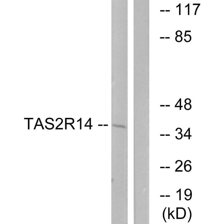 Western Blot - Anti-TAS2R14 Antibody (G753) - Antibodies.com