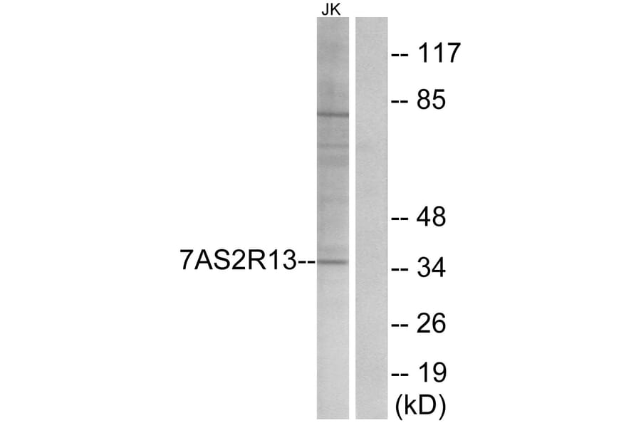 Western Blot - Anti-TAS2R13 Antibody (G752) - Antibodies.com