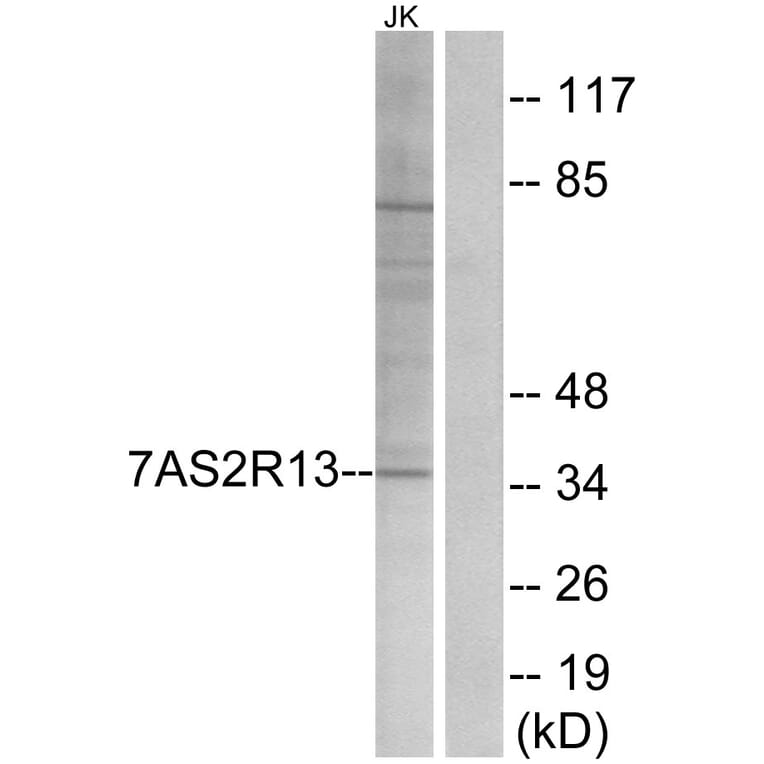 Western Blot - Anti-TAS2R13 Antibody (G752) - Antibodies.com
