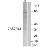 Western Blot - Anti-TAS2R13 Antibody (G752) - Antibodies.com