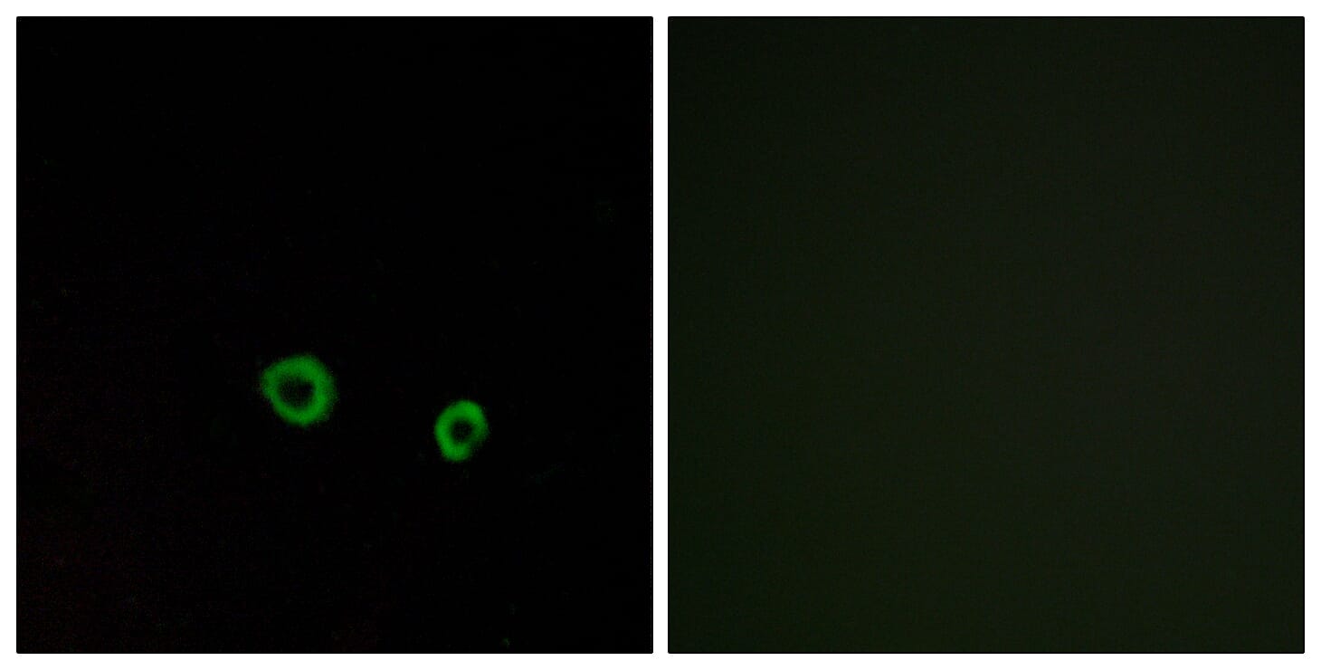 Immunofluorescence analysis of MCF7 cells using Anti-TAS2R10 Antibody. The right hand panel represents a negative control, where the antibody was pre-incubated with the immunising peptide.
