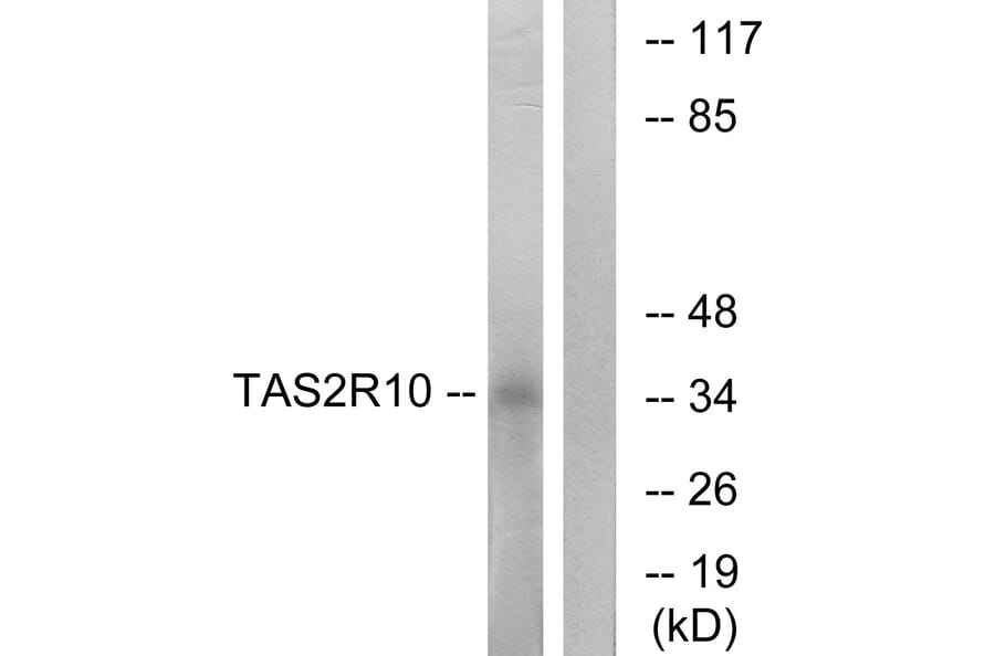 Western Blot - Anti-TAS2R10 Antibody (G750) - Antibodies.com