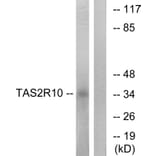 Western Blot - Anti-TAS2R10 Antibody (G750) - Antibodies.com