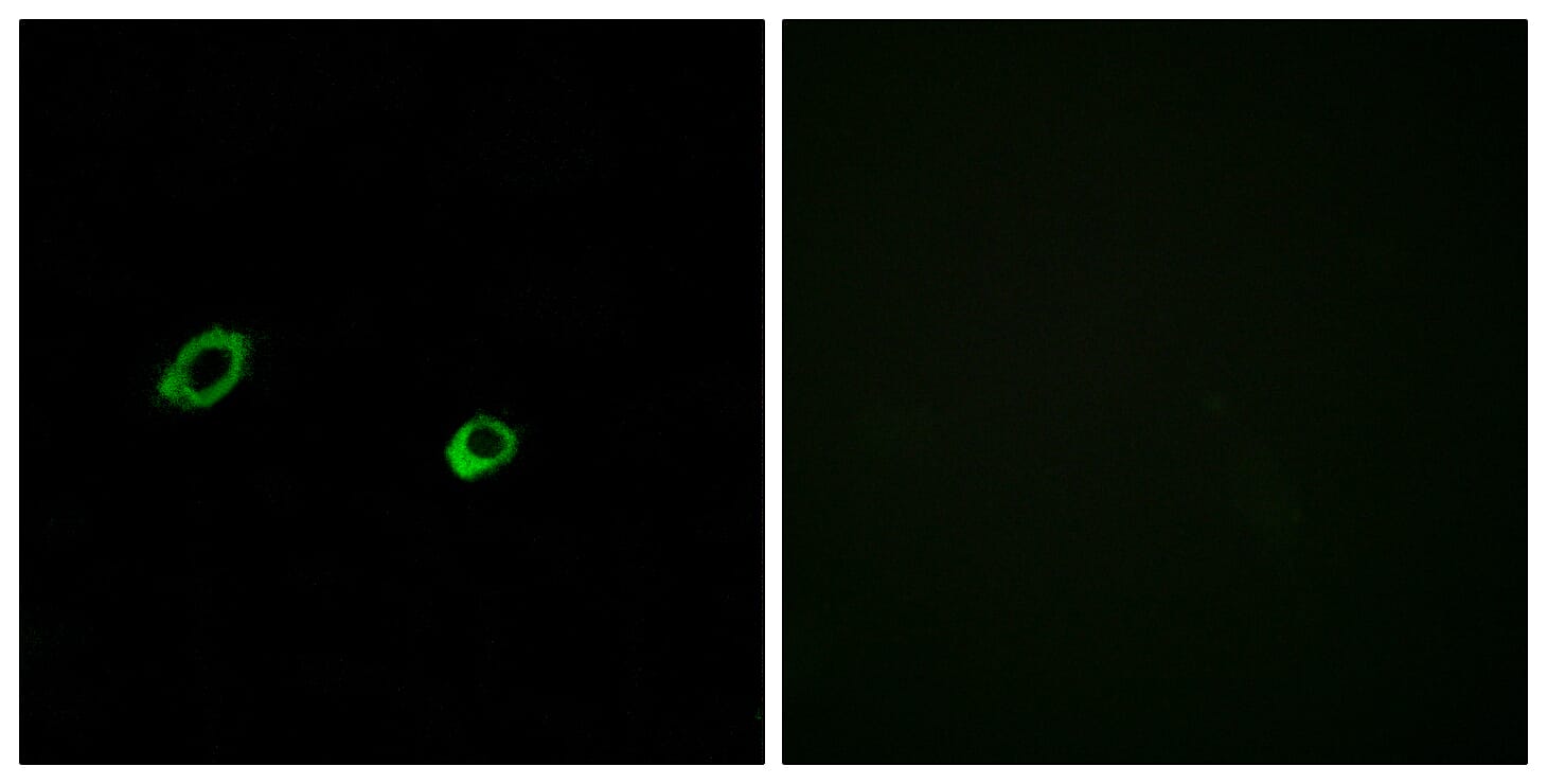 Immunofluorescence analysis of MCF7 cells using Anti-OR10AG1 Antibody. The right hand panel represents a negative control, where the antibody was pre-incubated with the immunising peptide.