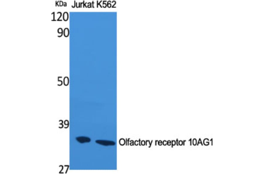 Western Blot - Anti-OR10AG1 Antibody (G417) - Antibodies.com