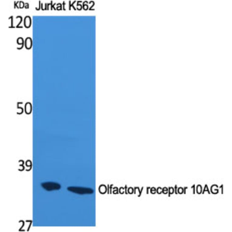 Western Blot - Anti-OR10AG1 Antibody (G417) - Antibodies.com