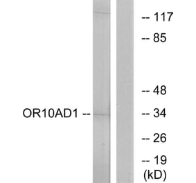 Western Blot - Anti-OR10AD1 Antibody (G416) - Antibodies.com