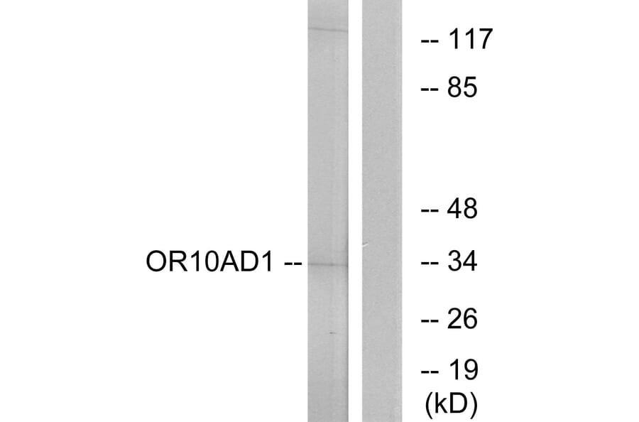 Western Blot - Anti-OR10AD1 Antibody (G416) - Antibodies.com
