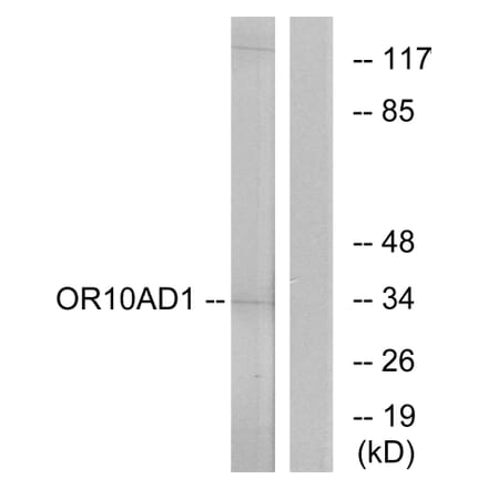 Western Blot - Anti-OR10AD1 Antibody (G416) - Antibodies.com