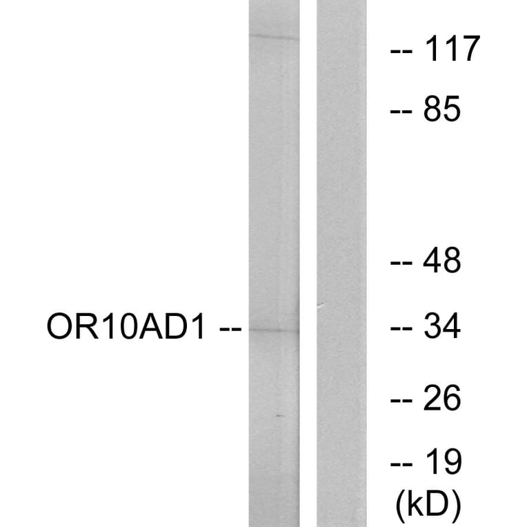 Western Blot - Anti-OR10AD1 Antibody (G416) - Antibodies.com