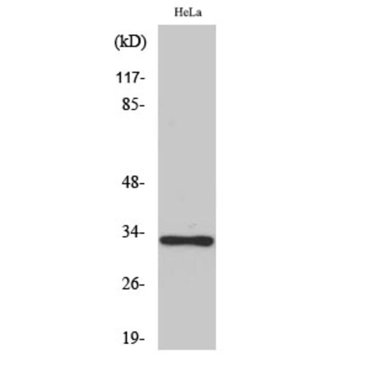 Western Blot - Anti-OR10AD1 Antibody (G416) - Antibodies.com