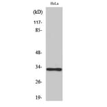 Western Blot - Anti-OR10AD1 Antibody (G416) - Antibodies.com