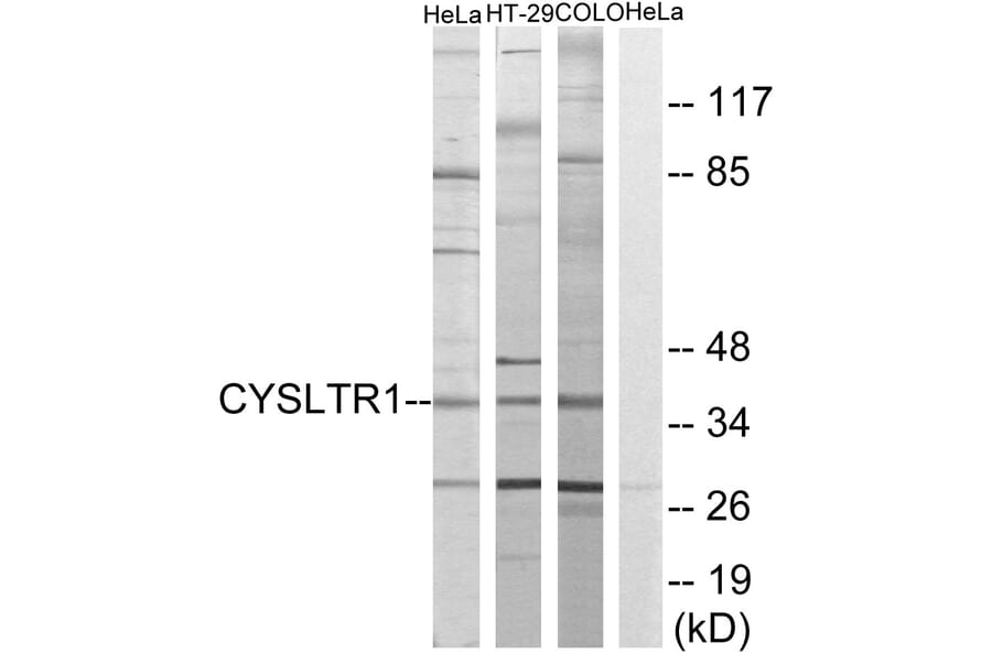 Western Blot - Anti-CYSLTR1 Antibody (G074) - Antibodies.com