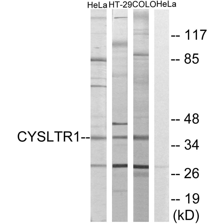 Western Blot - Anti-CYSLTR1 Antibody (G074) - Antibodies.com