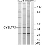 Western Blot - Anti-CYSLTR1 Antibody (G074) - Antibodies.com