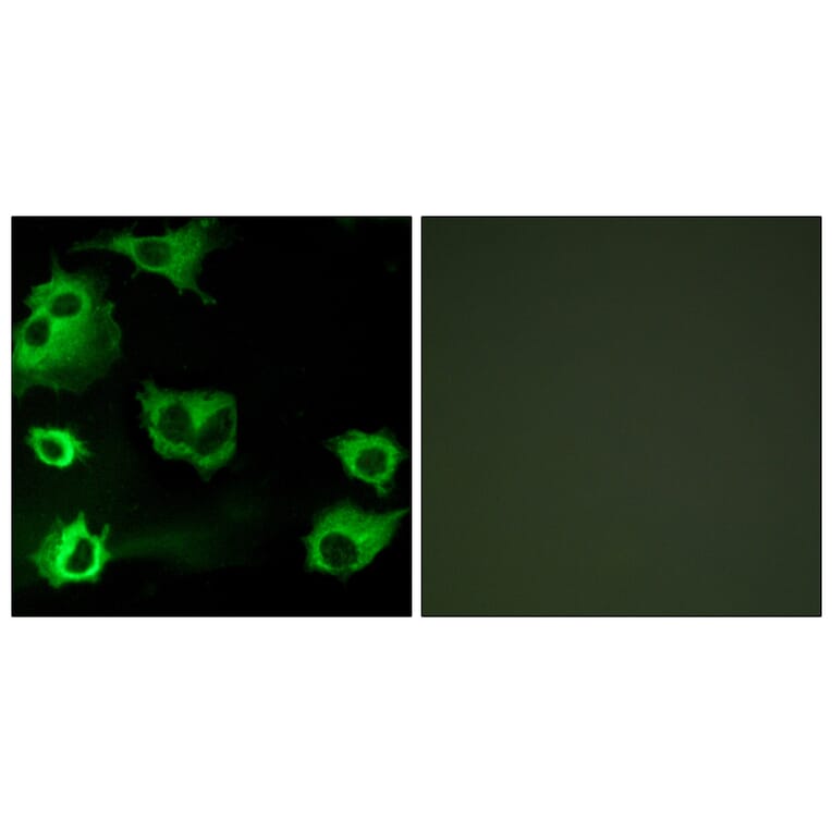 Immunofluorescence - Anti-CYSLTR1 Antibody (G074) - Antibodies.com