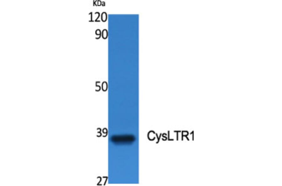Western Blot - Anti-CYSLTR1 Antibody (G074) - Antibodies.com