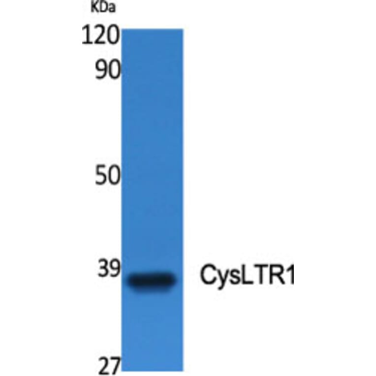 Western Blot - Anti-CYSLTR1 Antibody (G074) - Antibodies.com