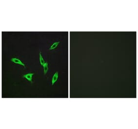 Immunofluorescence - Anti-ADORA2B Antibody (G203) - Antibodies.com