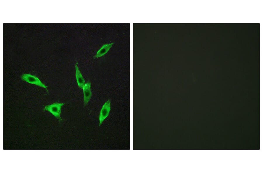 Immunofluorescence - Anti-ADORA2B Antibody (G203) - Antibodies.com