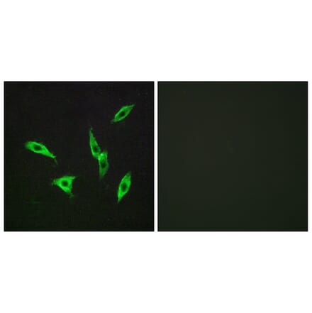 Immunofluorescence - Anti-ADORA2B Antibody (G203) - Antibodies.com